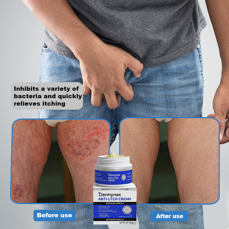 👉 Official Store: PCA-Magnesium Herbal Intimate – Multi‑Purpose Relief for Scalp Itching, Eczema, Jock Itch, Facial Acne & Fungal Infections | Herbal Extracts, Steroid‑Free, No Artificial Fragrances, Gentle for All Skin Types【Tax Free】