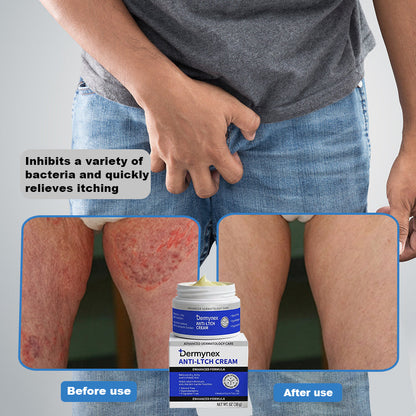 👉 Official Store: PCA-Magnesium Herbal Intimate – Multi‑Purpose Relief for Scalp Itching, Eczema, Jock Itch, Facial Acne & Fungal Infections | Herbal Extracts, Steroid‑Free, No Artificial Fragrances, Gentle for All Skin Types【Tax Free】