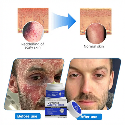👉 Official Store: PCA-Magnesium Herbal Intimate – Multi‑Purpose Relief for Scalp Itching, Eczema, Jock Itch, Facial Acne & Fungal Infections | Herbal Extracts, Steroid‑Free, No Artificial Fragrances, Gentle for All Skin Types【Tax Free】