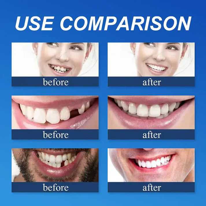 Ends Today: 70% OFF! ⏰70% OFF! KLENIMORE™ Medical Full Denture with Strong Suctiond Custom-Fit Full Functional Dentures🦷Obtain American Dental Association (ADA) Certification